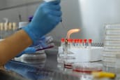 Image for Fractyl Health Stock Collapses As GUTS Faces Class Action Over Revita Data recomended post