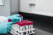 Image for REGN Surges As Regeneron Smashes Q3 Earnings And Wins Upgrades recomended post