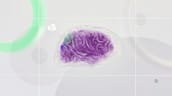Image for SPRC Stock Jumps As SciSparc Advances Tourette Trial And AI Pivot recomended post